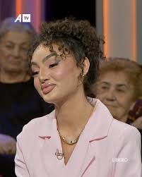 Doktoresha e thotë hapur; Edhe meshkujt po i mbushin buzët filler vajzat  tashmë janë çdo e dyta me buzë të mbushura, #atv #libero