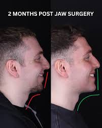 Dr. David Alfi DDS MD FACS (@dr.davidalfi) • Instagram photos and videos