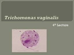 Image result for trichomonas images