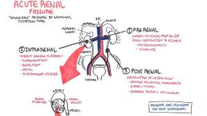 Once renal failure becomes established and supportive care is initiated duration of oliguria and inadequate excretory function is variable. Acute Renal Failure Youtube