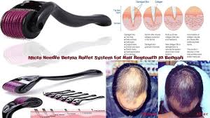 The good news is the maliniak method must really be impressing and scaring the crap out of a lot of people in the hair loss business with the growing evidence of how effective it is and with all the unsolicited testimonials we have seen all over the internet about people getting great results. Darma Roller For Hair Growth Posts Facebook