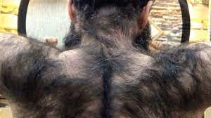 This Man's Back Hair Transformation Is Going Viral on Instagram | Allure