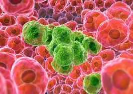 What does cancer look like? Cancer Time