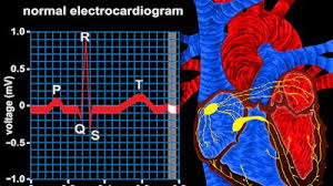 Image result for Electrocardiogram Validity