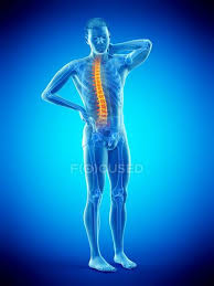 Maybe you would like to learn more about one of these? Front View Of Male Body With Back Pain Conceptual Illustration Anatomical Discomfort Stock Photo 308624656
