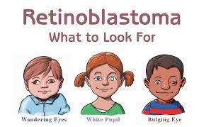 You can usually control symptoms at home, but sometimes. Trust Your Instincts Early Diagnosis Key To Effective Treatment Of Childhood Eye Cancer New York Eye Cancer Center
