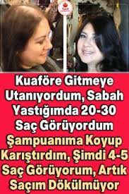 Sacimin Dokulmesinden Bu Sayede Kurtuldum Saclarinizin Eskisi Gibi Guzel Ve Bakimli Olmasini Istiyorsan Sac Dokulme Tedavileri Dogal Sac Bakimi Saglikli Sac