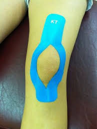 Kt tape is used in multiple shapes depending on the size of the injury and the result the sufferer is expecting. Kinesiology Taping Physiopedia