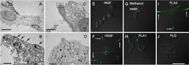 What is lithium and does it have any medical uses? Functional Compartmentalization Of The Plasma Membrane Of Neurons By A Unique Acyl Chain Composition Of Phospholipids Journal Of Biological Chemistry