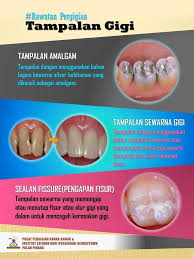 So now, biarlah saya update apa yg jadi sekarang je eh.aci kan?hehe. Tampalan Gigi Jabatan Kesihatan Negeri Pulau Pinang Facebook