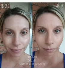 How to clear face breakouts caused by steroids?