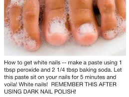 How To Whiten Stained Nails I Have Not Gone Without Polish On My Toe Nails In Forever But They Were Starting To L Stained Nails White Toenails Beauty Hacks
