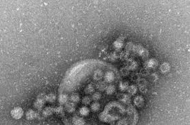 People sometimes refer to a norovirus infection. Norovirus Ubelst Ansteckend Wissen Stuttgarter Zeitung