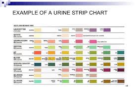 urinalysis