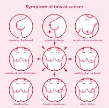 However, these changes can occur as part of. Nhs London On Twitter October Is Breastcancerawarenessmonth So What Better Time To Get Familiar With The Signs And Symptoms Of Breast Cancer Make Sure You Check Your Breast Regularly For Changes Like