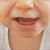 Ces dents sont temporaires et vont « tomber » successivement pour être remplacées par des dents définitives plus grandes et plus résistantes. 1