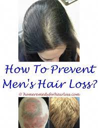 There is no prenatal vitamin that can prevent this or treat it alone. Can Prenatal Vitamins Cause Hair Loss Vitaminwalls