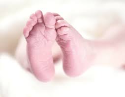 Clubfoot can also occur as part of an underlying genetic syndrome, such as trisomy 18. Clubfoot Treatment In Iran Best Doctors Clinics Free Consultation