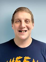 Bob's Smile Transformation and All-On-4