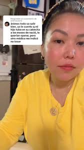 Tratamiento de Hemangioma Capilar en Bebés: Mi Experiencia