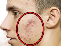 Cancer gives most people no symptoms or signs that exclusively indicate the disease. à®†à®£ à®•à®³ à®• à®• à®ª à®± à®± à®¨ à®¯ à®µà®°à®ª à®µà®¤à®± à®• à®© à®…à®± à®• à®± à®•à®³ 9 Symptoms Of Cancer In Men Tamil Boldsky