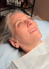 Sent client to Dermatologist for suspicious growths, they removed and  cleared margins thankfully. Huge hair reduction with a few left in his  treatment package. It's a good day.