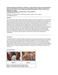 A department of veterans affairs cooperative study. Pdf Clinical Tetrad Of Arthritis Urethritis Conjunctivitis And Mucocutaneous Lesions Hla B27 Associated Spondyloarthropathy Reiter Syndrome Report Of A Case