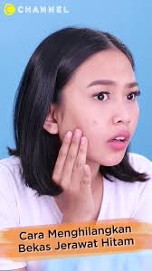 Sebab, struktur kulit wajah dan punggung juga tak sama. Cara Menghilangkan Bekas Jerawat Hitam C Channel