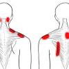 See easy levator scapulae stretch for neck pain. 1