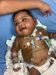 Dr Seuss Week in the NICU be like... We just received word that Luca might  be possibly ready for his LAST reconnection surgery! His surgeon will be  coming to take a look