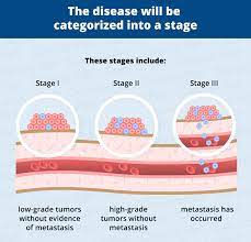 A number of other tests are also required to check if the cancer has spread to other parts of the body such as the lungs and the liver. Bone Cancer Osteosarcoma In Dogs Canna Pet
