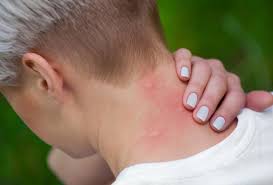 Along with the removal of tumors or lymph nodes, a surgeon sometimes needs to remove other structures on your neck like muscle, nerves, vein, or a gland. Lump On Neck Causes And Pictures