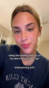 i wish you guys could’ve seen the day after the fourth, it swole up half my  face. I RECOMMEND THOUGH!! 10000/10 #medusa #piercing #new #piercing  #foryoupage #piercingcheck #fypage