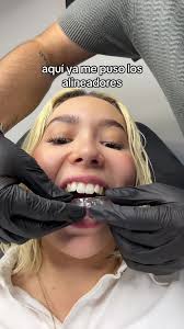 Respuesta a @Lourdes Estrella mi dentista personal 🦷 @Dr Juan Pablo  Cervantes #lilycuenta