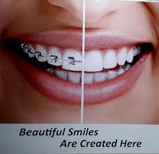 Check spelling or type a new query. Samadhan Clip Braces Dental Clinic Dentists Book Appointment Online Dentists In Panchavati Nashik Justdial
