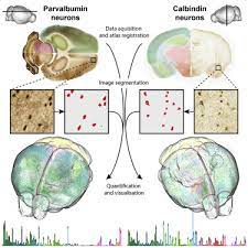 Paxinos, george, and charles watson. Densities And Numbers Of Calbindin And Parvalbumin Positive Neurons Across The Rat And Mouse Brain Sciencedirect