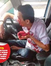 Check spelling or type a new query. Cedera Diserang Batu Terbang Pressreader