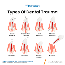 Image result for Tooth Luxation