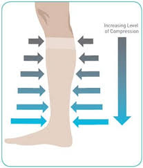 Maybe you would like to learn more about one of these? Controlling Swelling With Compression Stockings Healogics