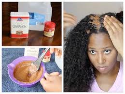Black Hair Biotin Hair Growth Before And After Pictures Super Hair Growth Mask Cheap Easy Natural Hair Mask For Growth Extreme Hair Growth Cinnamon Hair