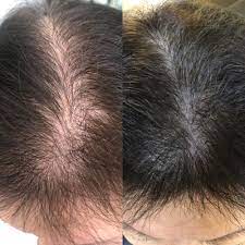 Fortunately, the isagenix system of cleanse and shake days is clinically shown to help boost metabolism and fat loss while preserving muscle mass. Collagen Elixir Marine Collagen Peptides Isagenix