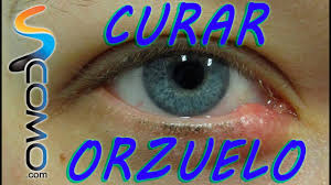 Como Eliminar Un Orzuelo Remedios Naturales Youtube