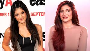 Fans were almost certain that jenner had enhanced her lips with cosmetic filler as. Kylie Jenner S Fans Order She Appears To Be Like Fully Assorted In Contemporary Kuwtk Trailer Look Pics Early Newspaper