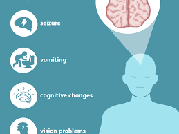 Other cancers that affect children include brain tumors, lymphoma, and soft tissue sarcoma. Signs And Symptoms Of A Brain Tumor