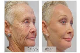 Image result for 01839373442