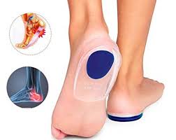 It is also called an osteophyte. Heel Spur Treatment Recovery Foot Pain Explored