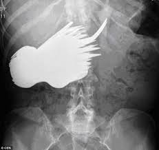 Each year, americans end up with a wide variety of objects stuck in their bums. 31 Funny X Ray Images That Seem Too Ridiculous To Be Real