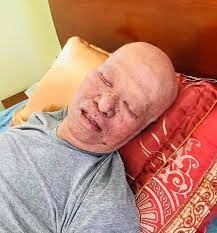 Chiến lược gia người hà đông đã chiến đấu đến cùng với bạo bệnh, nhưng dù được. Ä'au Long Hinh áº£nh Hlv Le Thá»¥y Háº£i Khong Con Sá»©c Sá»'ng Vi Ung ThÆ° Tá»¥y