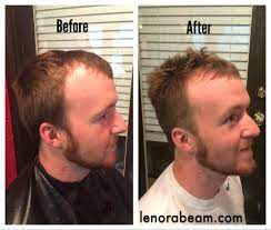 Millions of men and women suffer from hair loss throughout the united states, and the most common first sign is a receding hairline. Men S Hair Wella Rugged Fix Before And After Makeover Guy Hair Frisuren Geheimratsecken