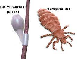 Bit Nasil Bulasir Nasil Temizlenir Evde Ilacsiz Bit Temizleme Yontemi